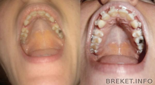 спустя 3 месяца