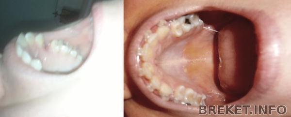 спустя 3 месяца_ спустя 3 месяца_
