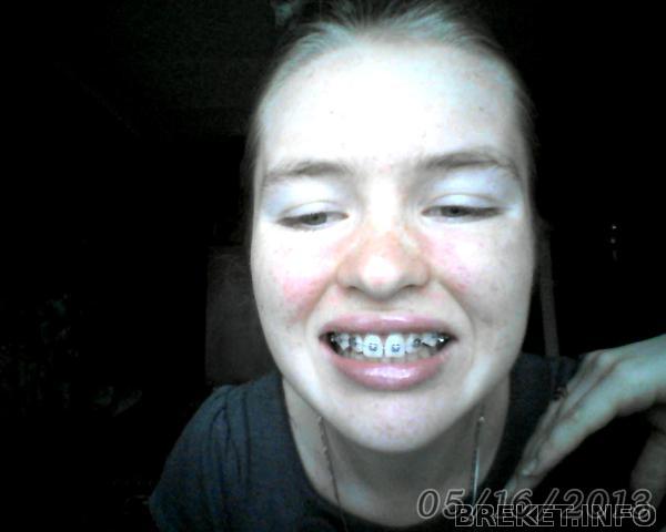 Вот что было