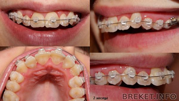 2 месяца 2 месяца