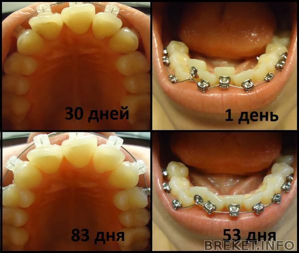 Снизу-вверх и наоборот.