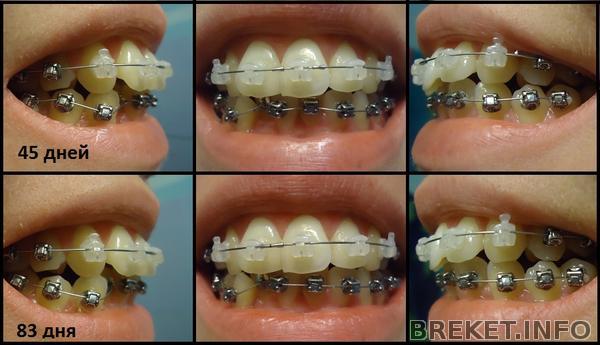 Фас-профиль.