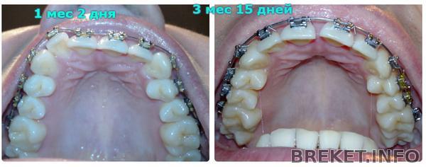 3 месяца 15 дней - в сравнении 1 мес 2 дня.jpg