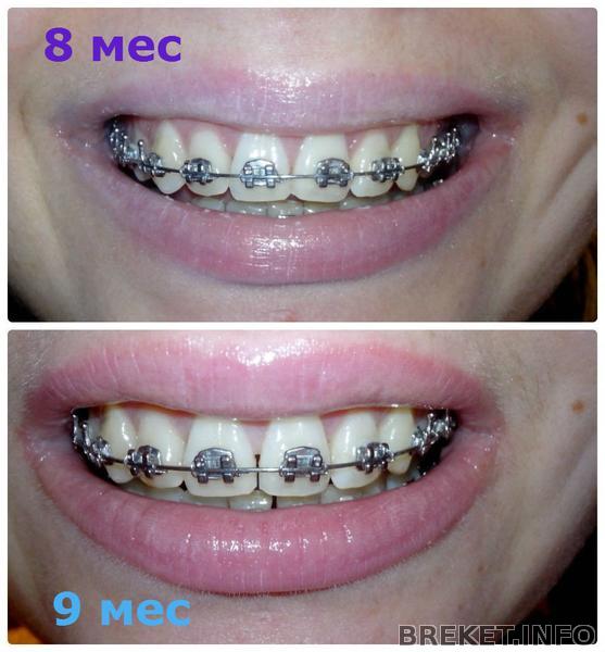 8_i_9_mesyac.jpg 8_i_9_mesyac.jpg