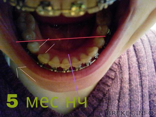 picsart_1396682460481.jpg picsart_1396682460481.jpg