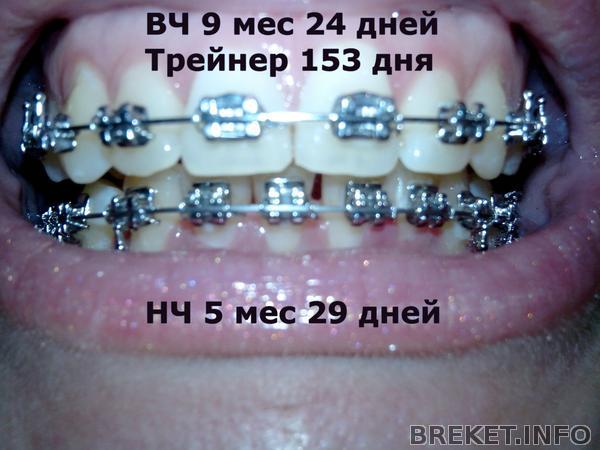 9.24_prikus_.jpg