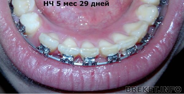 9_24_i_nch5_mes_29.jpg