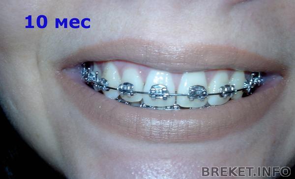 10_mes.jpg 10_mes.jpg