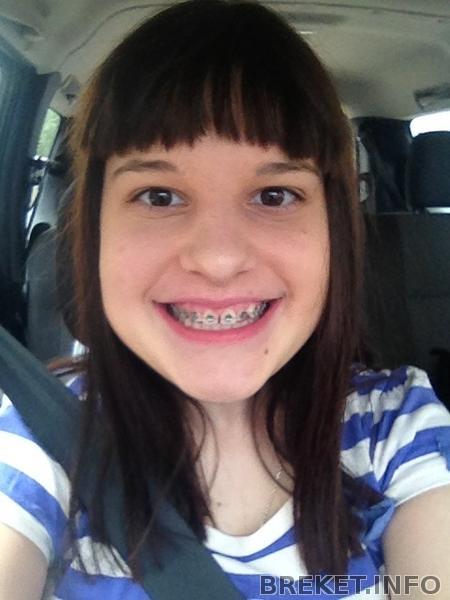 После установки