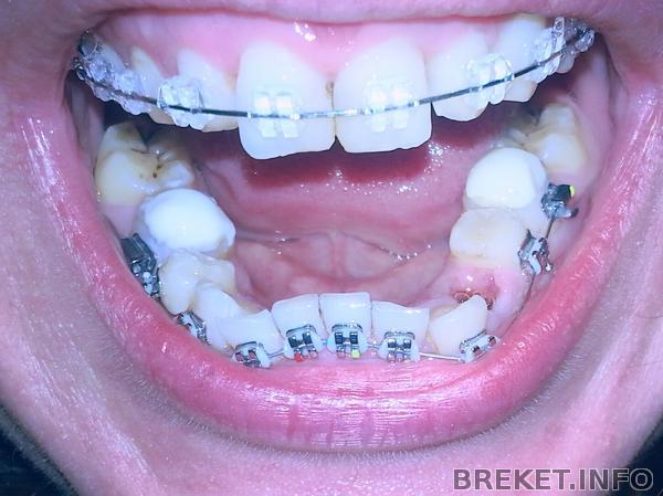 первый день нч