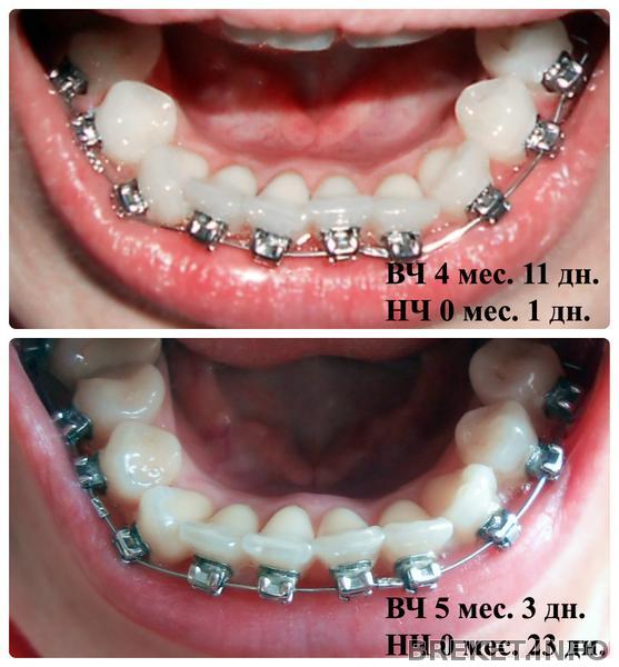kollazh26.jpg kollazh26.jpg