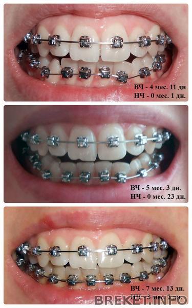 kollazh30.jpg kollazh30.jpg