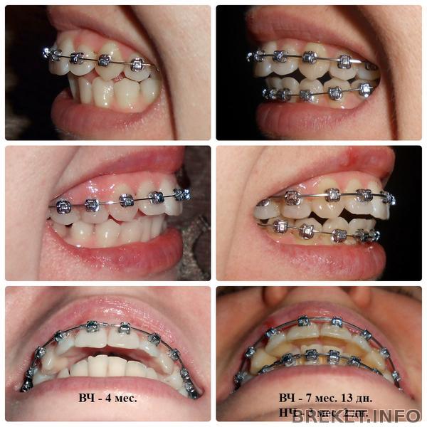 kollazh31.jpg kollazh31.jpg