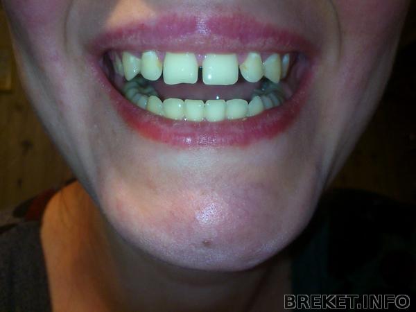 Вот и сняли(