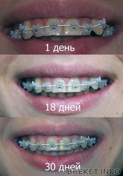 07.10.2013_1_mesyac_vch_2.jpg