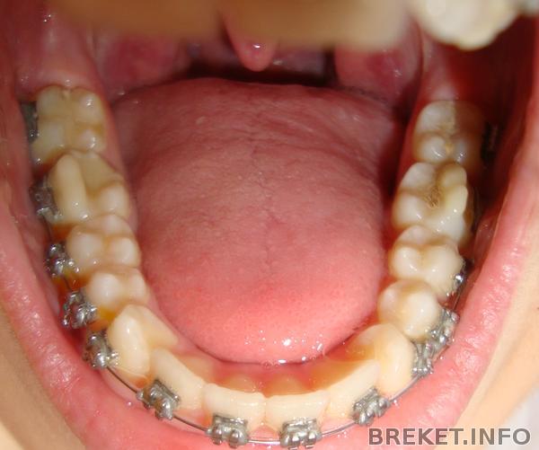 dsc08976.jpg dsc08976.jpg