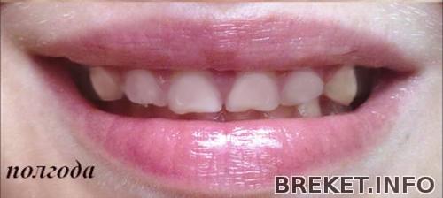 murjaka.jpg murjaka.jpg