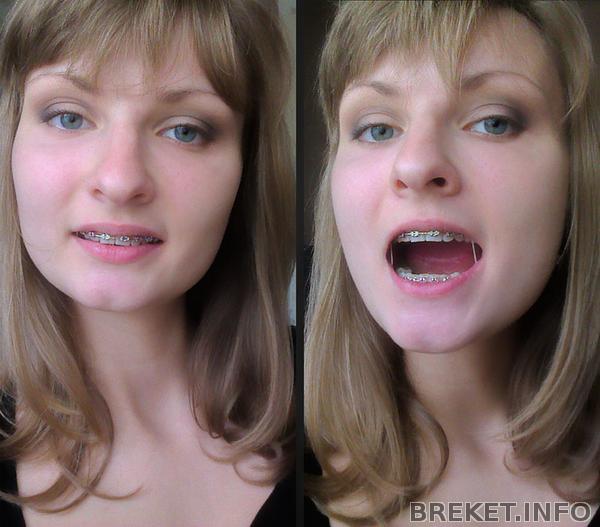 жизнь с тягами