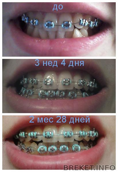 fotor010811940.jpg fotor010811940.jpg