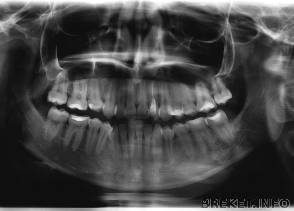 elena_entipov.jpg elena_entipov.jpg