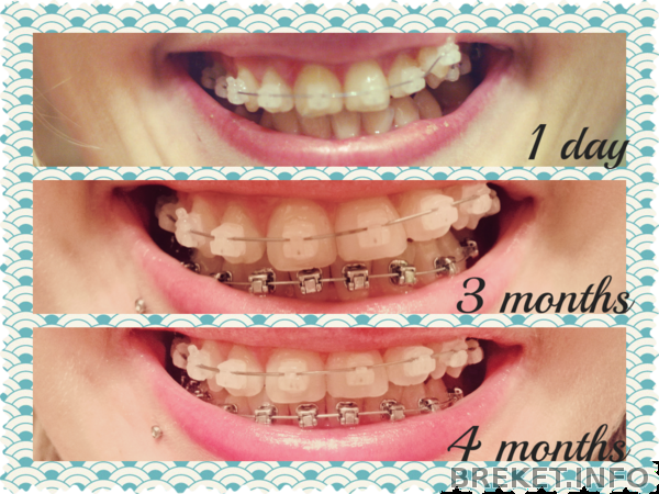 fotor0226135725.png fotor0226135725.png