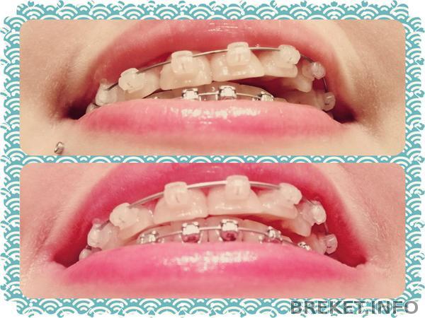 fotor0226140233.jpg fotor0226140233.jpg