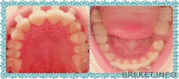 fotor022614058.jpg fotor022614058.jpg