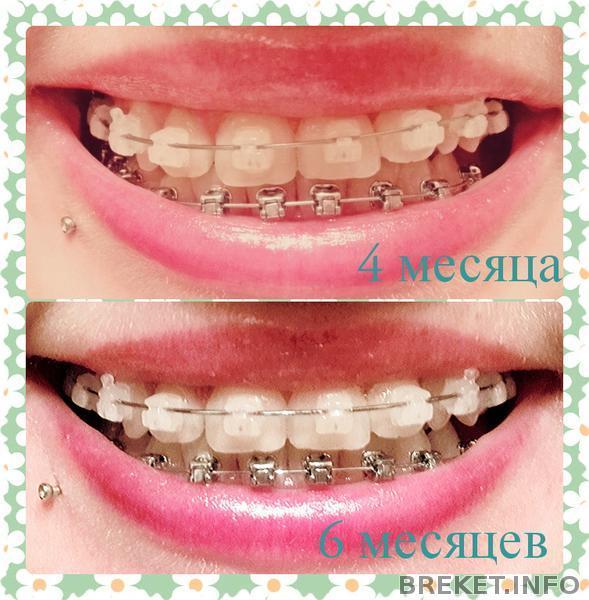 fotor0425154249.jpg