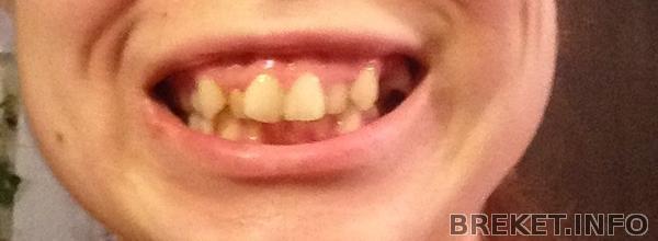 За день до установки