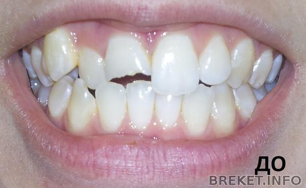 ДО УСТАНОВКИ