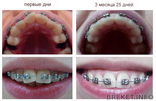прогресс в лечении