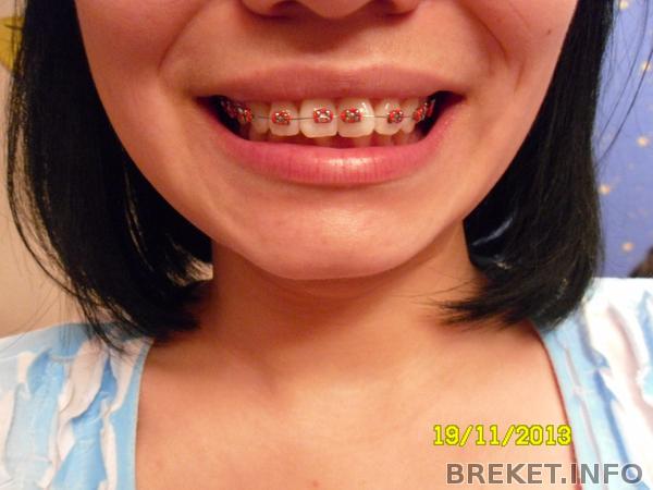 Красненькие лигатурки)1 месяц.jpg