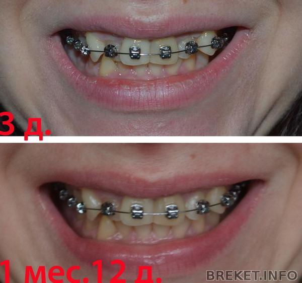 нам 1 мес. 12 дней