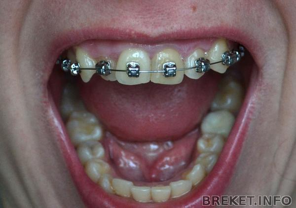 dsc_0701.jpg dsc_0701.jpg