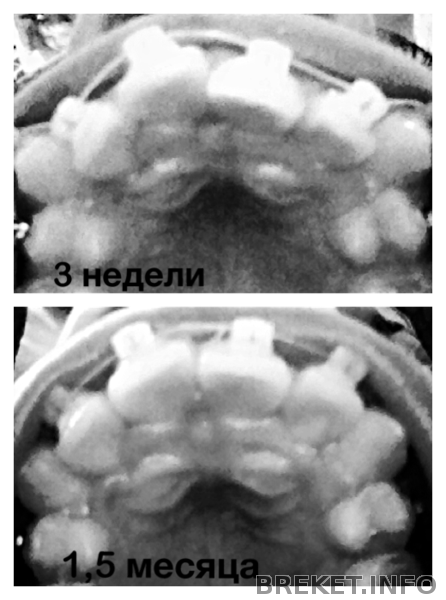 движение движение