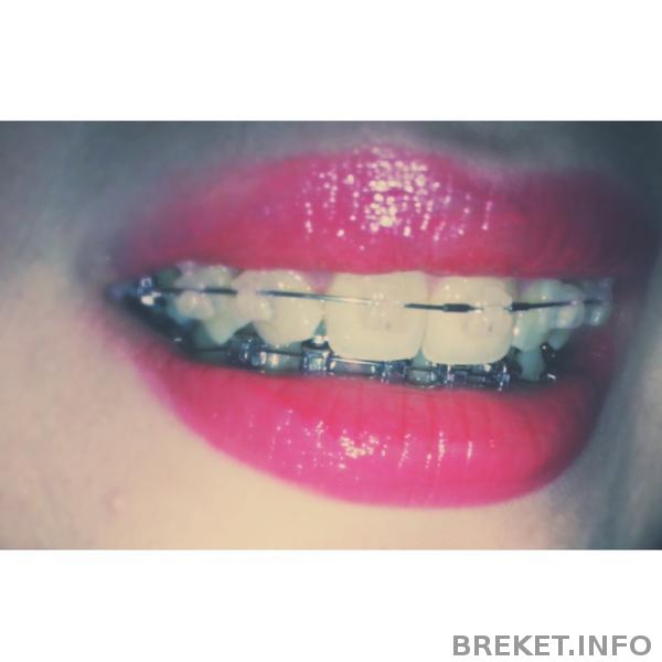 Улыбка с яркой помадой