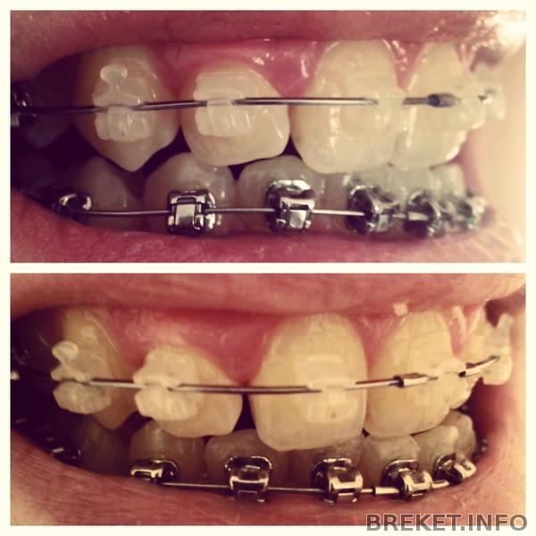 24 часа спустя