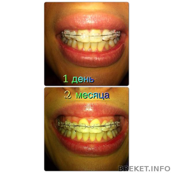 2 месяца 2 месяца