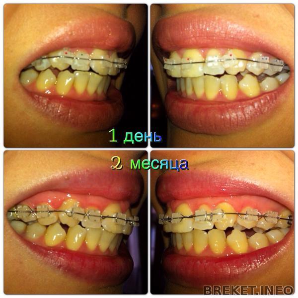 2 месяца 2 месяца