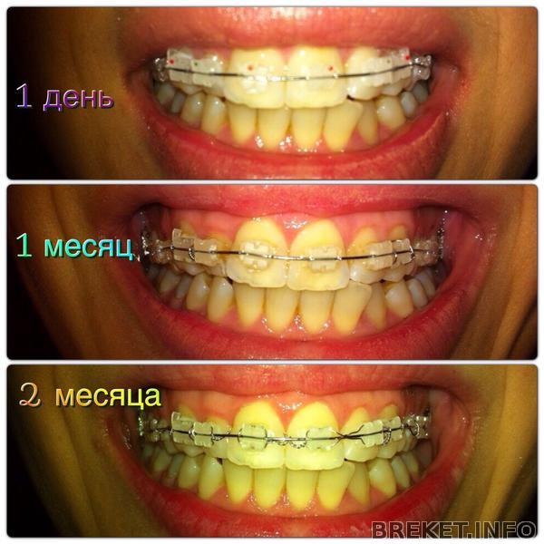 2 месяца 2 месяца