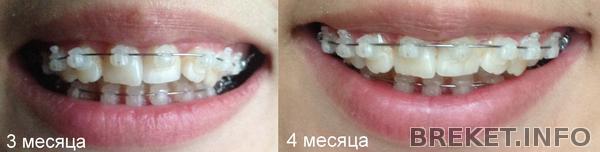 4_mesyaca.jpg