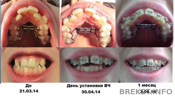 rezultaty.jpg