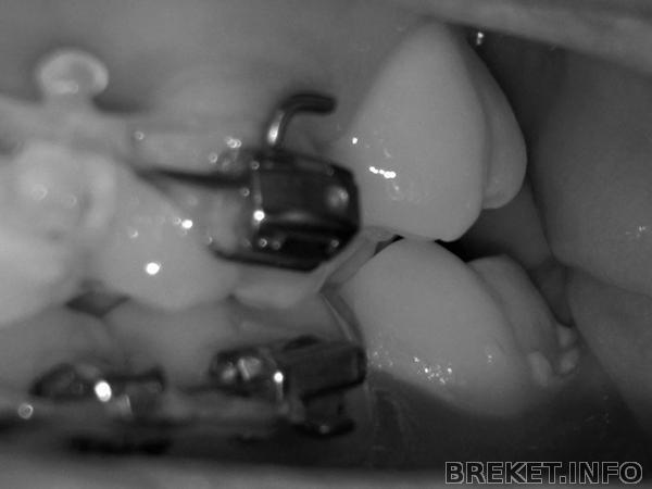 010120111640.jpg