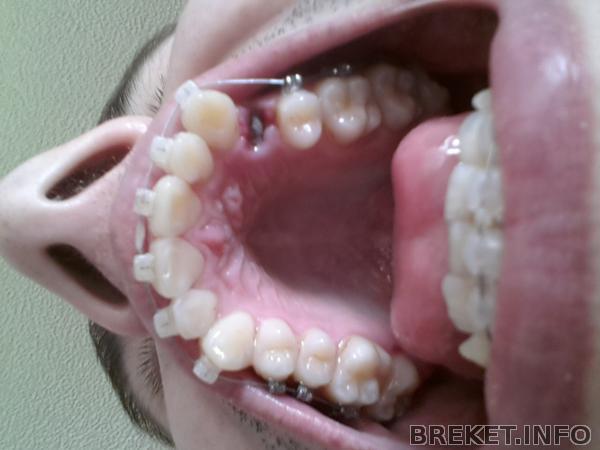 20140420_154615.jpg
