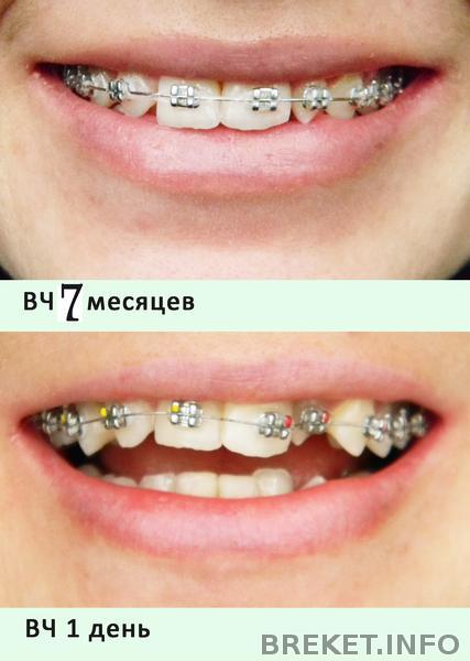 kollazh_7_mesyacev.jpg