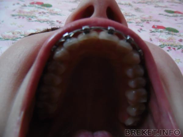 Верх