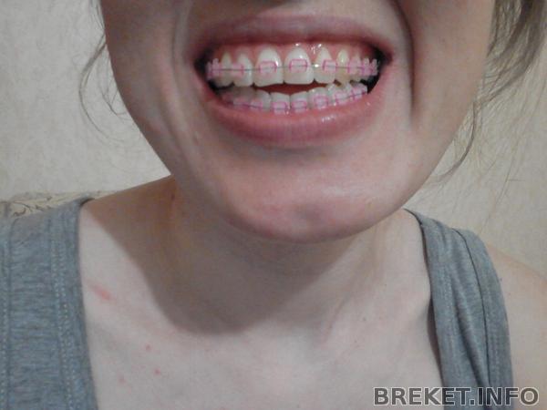 20140418_064138.jpg