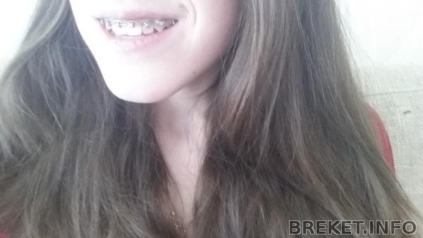 20150307_131111.jpg