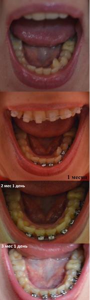 nch_3_mesyac_1_den.jpg
