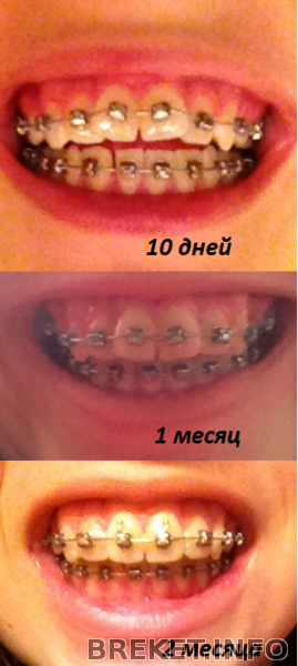 collage1.png
